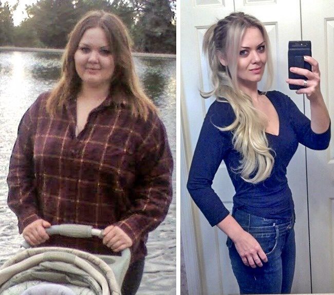 See the pictures of Before After after losing weight